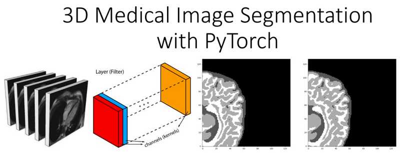 Deep learning in medical imaging - 3D medical image segmentation with PyTorch