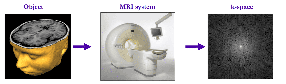mri-image-acquitision-overview