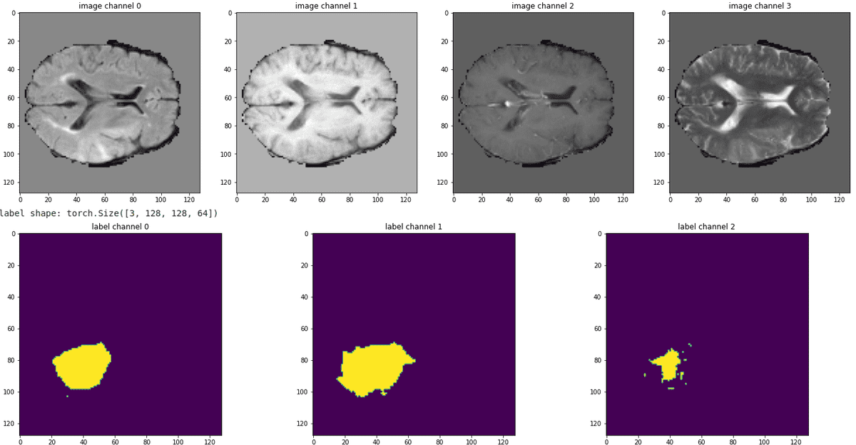 brain-mri-data-visualization