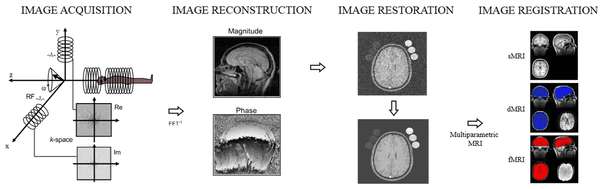 deep-learning-mri-application-overview