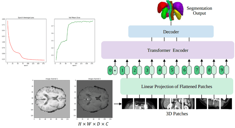 3D Medical image segmentation with transformers tutorial