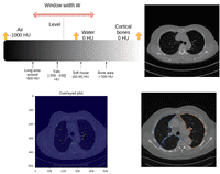 Introduction to medical image processing with Python: CT lung and ...