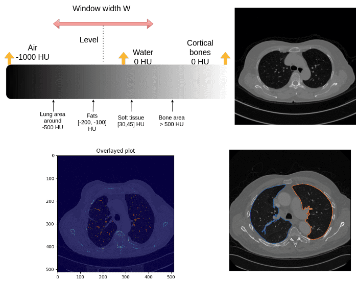 Introduction to medical image processing with Python: CT lung and vessel segmentation without labels