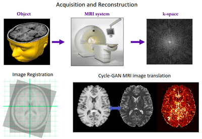 Deep Learning In MRI Beyond Segmentation: Medical Image Reconstruction ...