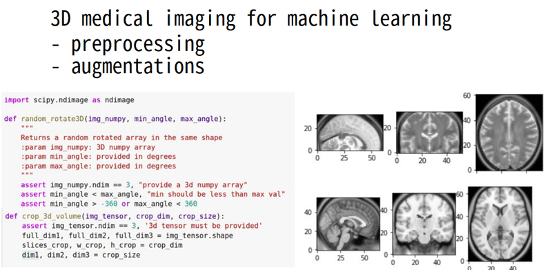 Introduction to 3D medical imaging for machine learning: preprocessing and augmentations