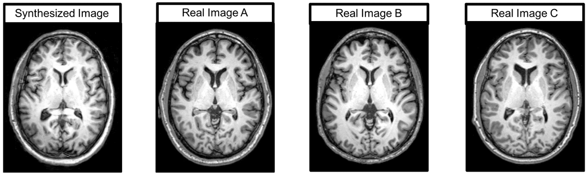 brain-mri-gans