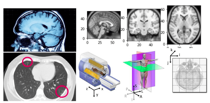 Understanding coordinate systems and DICOM for deep learning medical image analysis